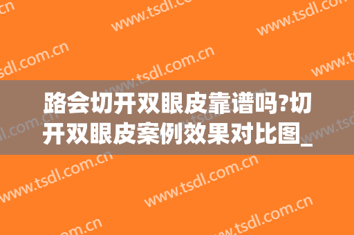 路会切开双眼皮靠谱吗?切开双眼皮案例效果对比图_中日友好医院(做过日式无痕双眼皮 再做全切双眼皮)