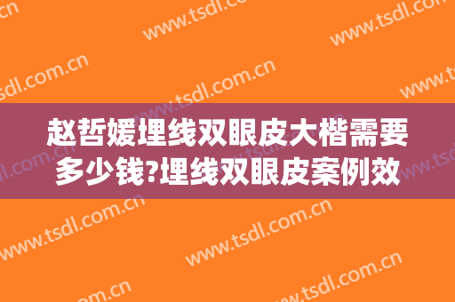 赵哲媛埋线双眼皮大楷需要多少钱?埋线双眼皮案例效果对比图_郑州大学附属洛阳中心医院
