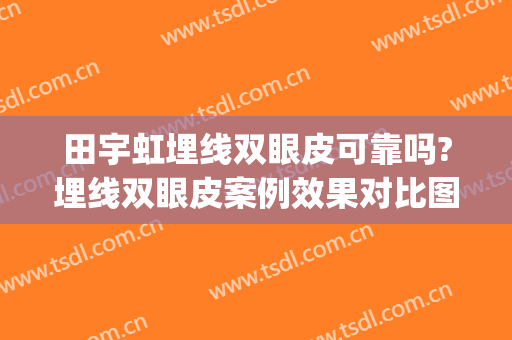 田宇虹埋线双眼皮可靠吗?埋线双眼皮案例效果对比图_蚌埠市第一人民医院