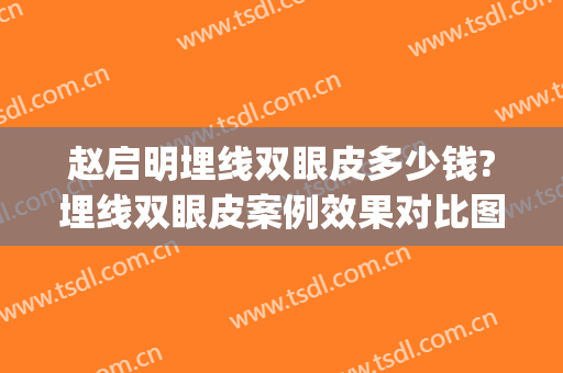 赵启明埋线双眼皮多少钱?埋线双眼皮案例效果对比图_浙江医院(埋线双眼皮成功的图片)
