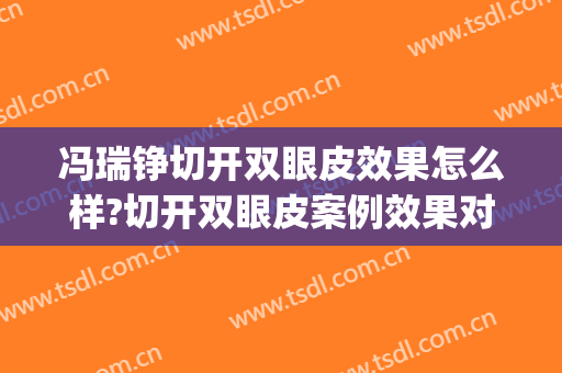 冯瑞铮切开双眼皮效果怎么样?切开双眼皮案例效果对比图_山西医科大学第一医院