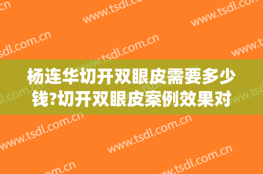 杨连华切开双眼皮需要多少钱?切开双眼皮案例效果对比图_嘉兴市第二医院