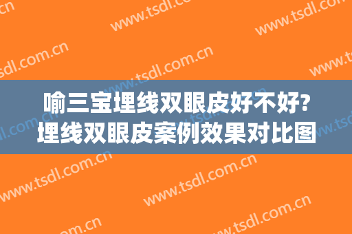 喻三宝埋线双眼皮好不好?埋线双眼皮案例效果对比图_义乌市中心医院
