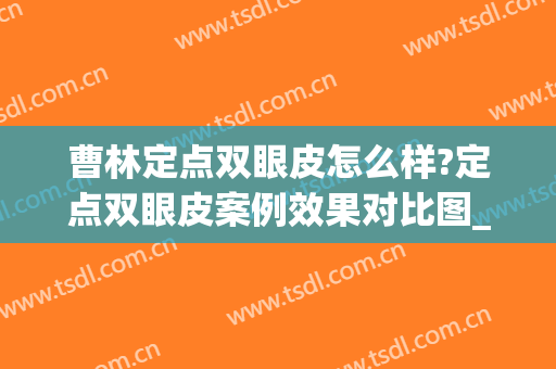 曹林定点双眼皮怎么样?定点双眼皮案例效果对比图_合肥市第二人民医院