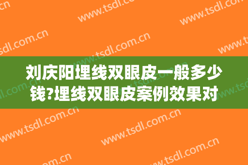 刘庆阳埋线双眼皮一般多少钱?埋线双眼皮案例效果对比图_好大夫工作室