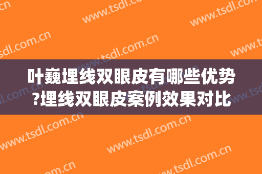 叶巍埋线双眼皮有哪些优势?埋线双眼皮案例效果对比图_中国科学院大学宁波华美医院