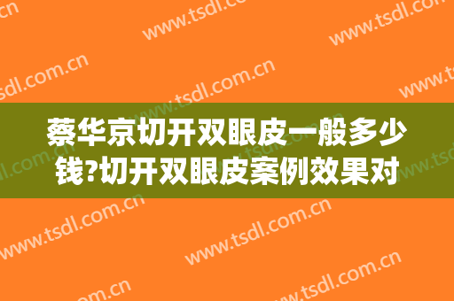 蔡华京切开双眼皮一般多少钱?切开双眼皮案例效果对比图_莱州市人民医院