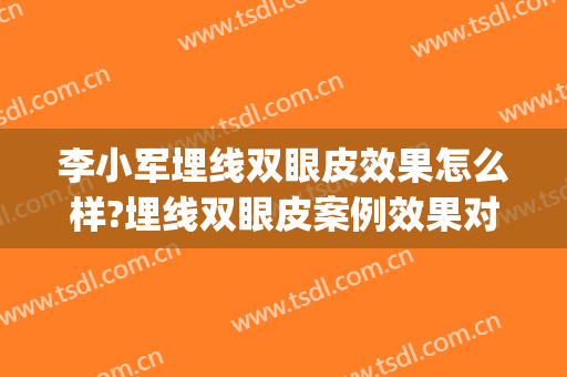李小军埋线双眼皮效果怎么样?埋线双眼皮案例效果对比图_深圳市人民医院