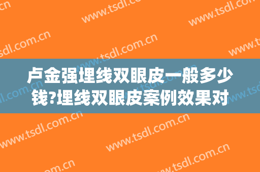 卢金强埋线双眼皮一般多少钱?埋线双眼皮案例效果对比图_暨南大学附属第一医院