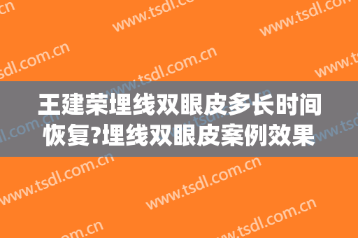 王建荣埋线双眼皮多长时间恢复?埋线双眼皮案例效果对比图_济南市第二人民医院