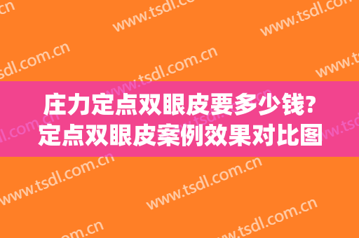 庄力定点双眼皮要多少钱?定点双眼皮案例效果对比图_中日友好医院(定点双眼皮百度百科)