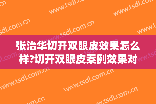 张治华切开双眼皮效果怎么样?切开双眼皮案例效果对比图_苏州市立医院