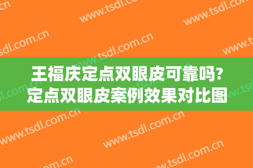 王福庆定点双眼皮可靠吗?定点双眼皮案例效果对比图_滨州市人民医院