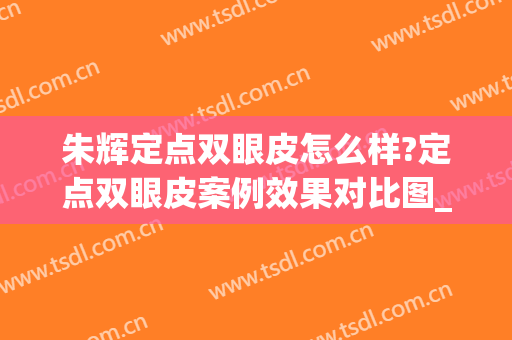 朱辉定点双眼皮怎么样?定点双眼皮案例效果对比图_北京大学深圳医院