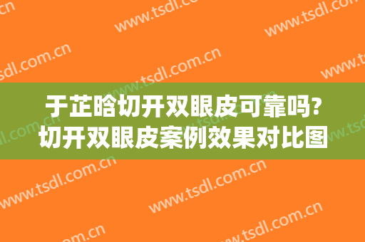 于芷晗切开双眼皮可靠吗?切开双眼皮案例效果对比图_大连大学附属新华医院