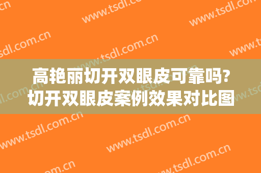 高艳丽切开双眼皮可靠吗?切开双眼皮案例效果对比图_南京市妇幼保健院