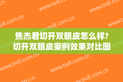 焦杰君切开双眼皮怎么样?切开双眼皮案例效果对比图_宜兴市人民医院