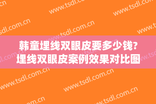 韩童埋线双眼皮要多少钱?埋线双眼皮案例效果对比图_联勤保障部队第九六〇医院