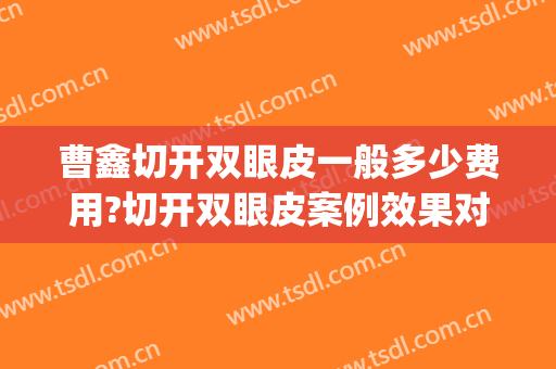 曹鑫切开双眼皮一般多少费用?切开双眼皮案例效果对比图_南通市第一人民医院