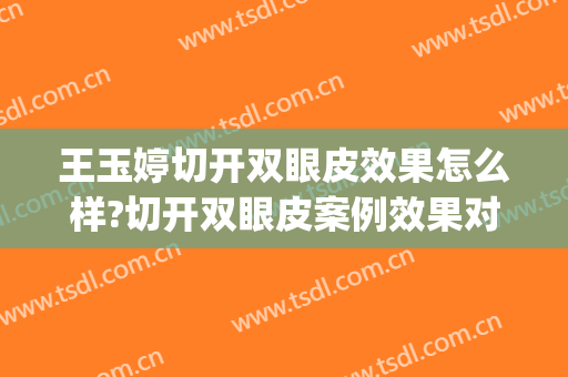王玉婷切开双眼皮效果怎么样?切开双眼皮案例效果对比图_烟台毓璜顶医院