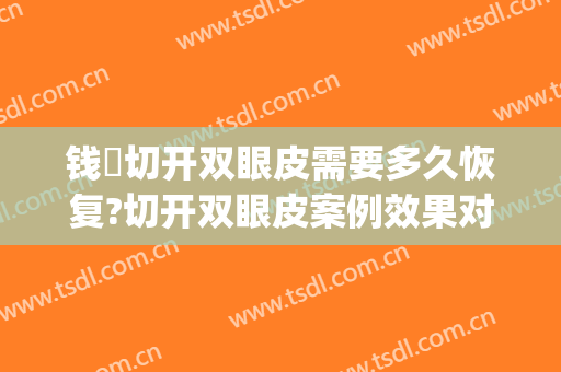 钱堃切开双眼皮需要多久恢复?切开双眼皮案例效果对比图_清远市人民医院