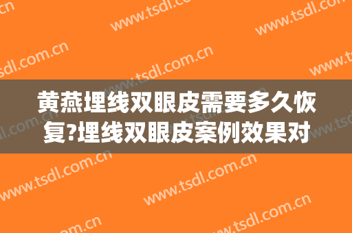 黄燕埋线双眼皮需要多久恢复?埋线双眼皮案例效果对比图_武汉市第三医院