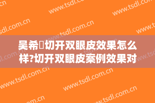 吴希晞切开双眼皮效果怎么样?切开双眼皮案例效果对比图_武汉市第三医院