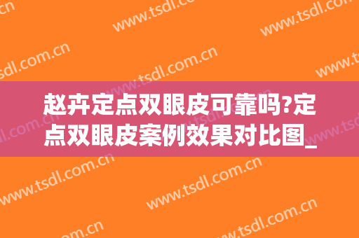 赵卉定点双眼皮可靠吗?定点双眼皮案例效果对比图_中山大学附属第三医院