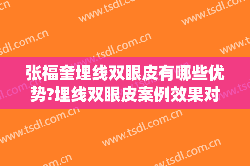 张福奎埋线双眼皮有哪些优势?埋线双眼皮案例效果对比图_聊城市人民医院