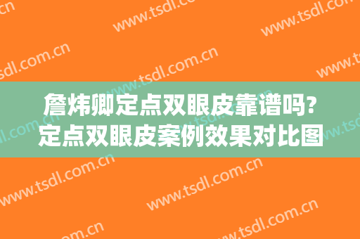 詹炜卿定点双眼皮靠谱吗?定点双眼皮案例效果对比图_广州医科大学附属第三医院