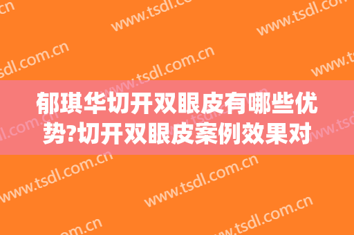 郁琪华切开双眼皮有哪些优势?切开双眼皮案例效果对比图_宁波市眼科医院