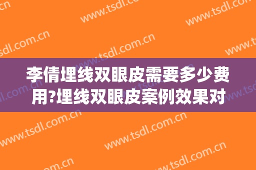 李倩埋线双眼皮需要多少费用?埋线双眼皮案例效果对比图_南京市妇幼保健院