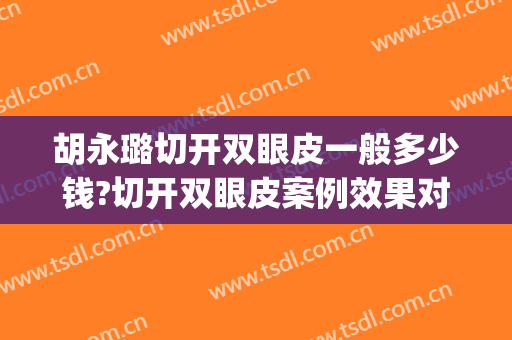 胡永璐切开双眼皮一般多少钱?切开双眼皮案例效果对比图_国药东风总医院