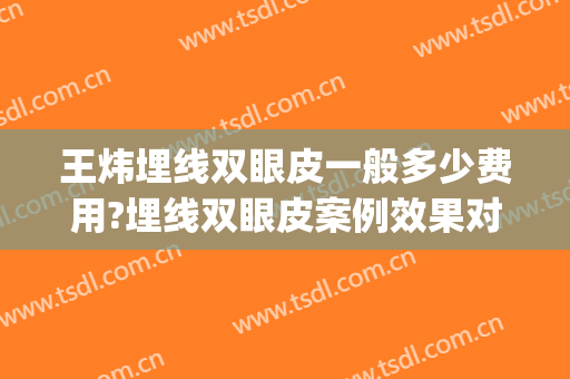王炜埋线双眼皮一般多少费用?埋线双眼皮案例效果对比图_中山市中医院