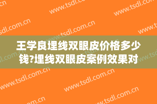 王学良埋线双眼皮价格多少钱?埋线双眼皮案例效果对比图_河北医科大学第四医院