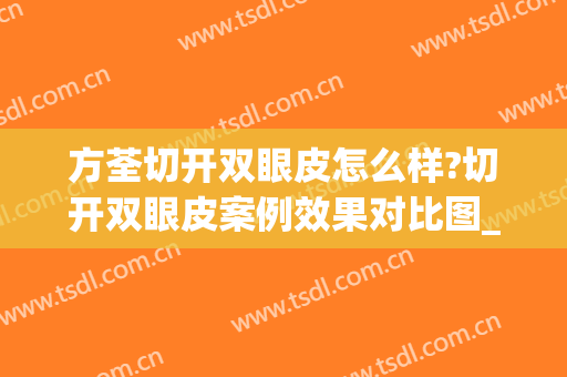 方荃切开双眼皮怎么样?切开双眼皮案例效果对比图_浙江大学医学院附属第二医院
