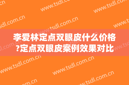 李爱林定点双眼皮什么价格?定点双眼皮案例效果对比图_武汉大学人民医院