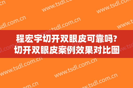 程宏宇切开双眼皮可靠吗?切开双眼皮案例效果对比图_淮安市第一人民医院
