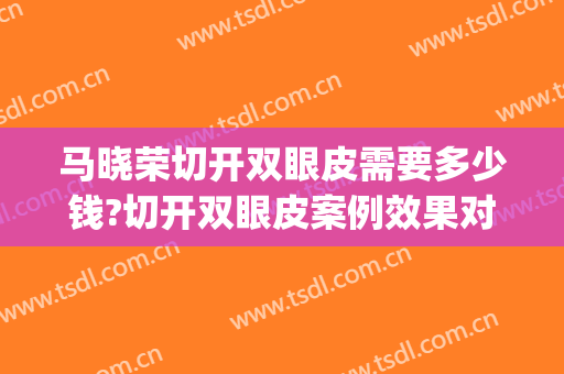 马晓荣切开双眼皮需要多少钱?切开双眼皮案例效果对比图_上海交通大学医学院附属新华医院