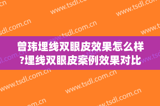 曾玮埋线双眼皮效果怎么样?埋线双眼皮案例效果对比图_好大夫工作室