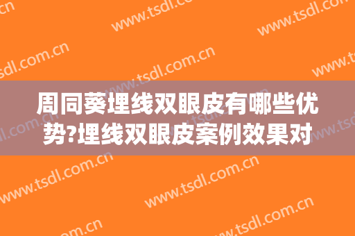 周同葵埋线双眼皮有哪些优势?埋线双眼皮案例效果对比图_徐州市中心医院