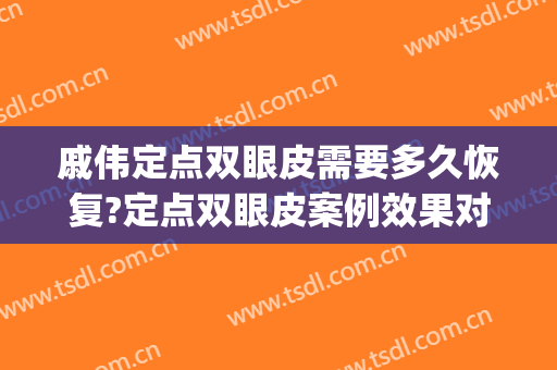 戚伟定点双眼皮需要多久恢复?定点双眼皮案例效果对比图_廊坊市人民医院