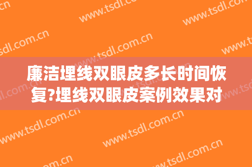 廉洁埋线双眼皮多长时间恢复?埋线双眼皮案例效果对比图_上海交通大学医学院附属第九人民医院