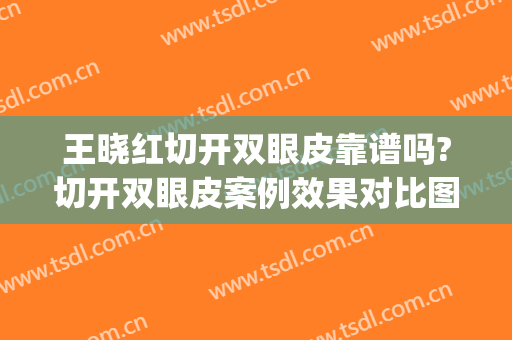 王晓红切开双眼皮靠谱吗?切开双眼皮案例效果对比图_威海市中心医院