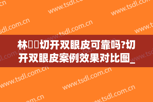 林珣珣切开双眼皮可靠吗?切开双眼皮案例效果对比图_中山大学附属第一医院
