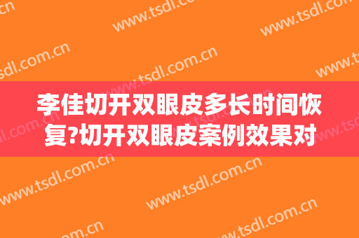 李佳切开双眼皮多长时间恢复?切开双眼皮案例效果对比图_好大夫工作室