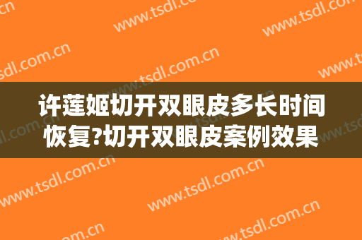 许莲姬切开双眼皮多长时间恢复?切开双眼皮案例效果对比图_首都医科大学附属北京同仁医院