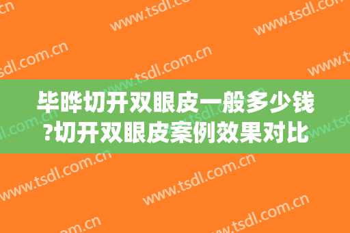 毕晔切开双眼皮一般多少钱?切开双眼皮案例效果对比图_北京大学人民医院