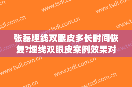 张磊埋线双眼皮多长时间恢复?埋线双眼皮案例效果对比图_浙江大学医学院附属第一医院