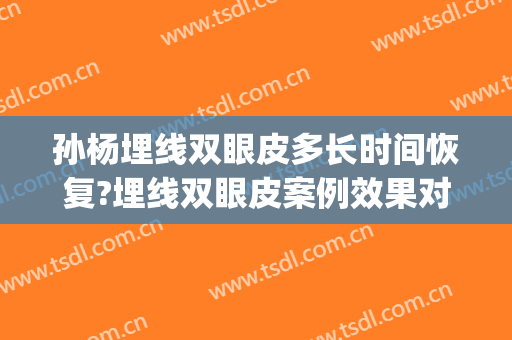 孙杨埋线双眼皮多长时间恢复?埋线双眼皮案例效果对比图_中南大学湘雅二医院